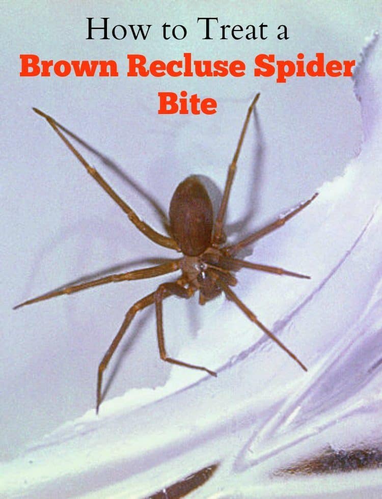 How To Treat A Brown Recluse Spider Bite ISaveA2Z