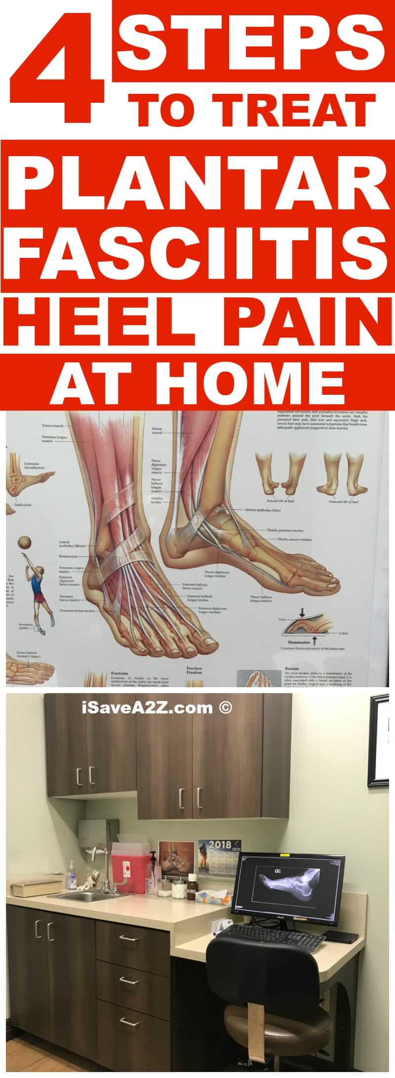 4 Steps To Treat Plantar Fasciitis Heel Pain At Home