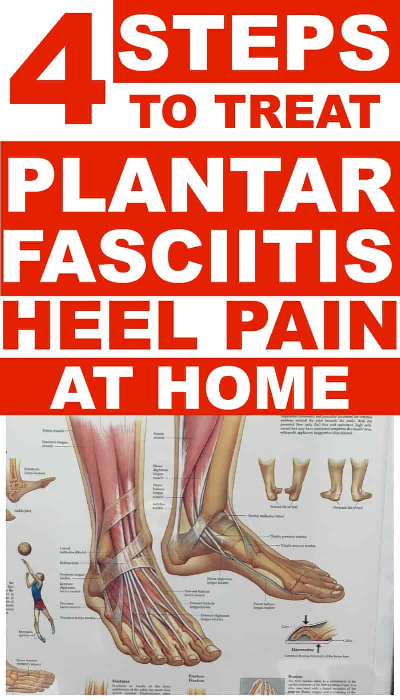 pain in heel treatment